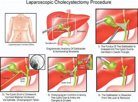 Pin on MS3 Surgery