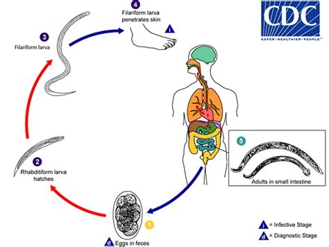 Hookworm infection, symptoms, diagnosis & hookworm treatment in humans