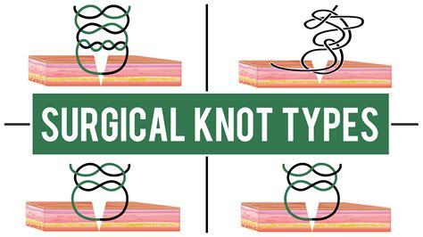 Common Surgical Knot Types | SurgMedia