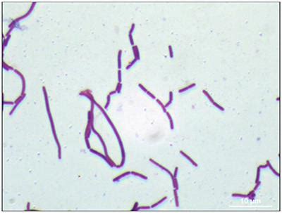 Lactobacillus Casei Gram Stain