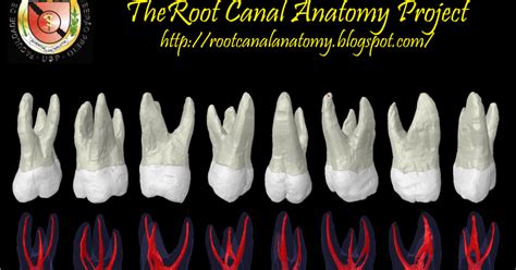 Maxillary First Molar Roots