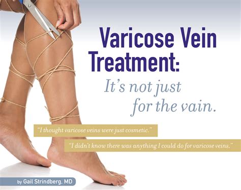 Varicose Vein Treatment | Northpointe Medical