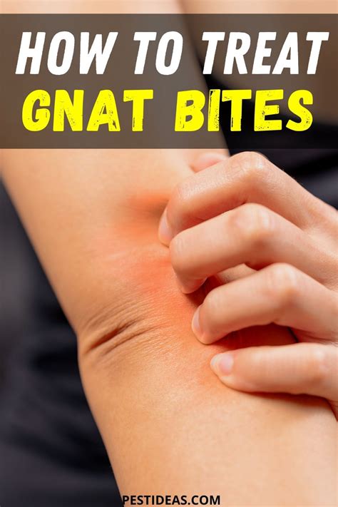 How to Treat Gnat Bites in 2020 | Gnat bites, How to get rid of gnats ...