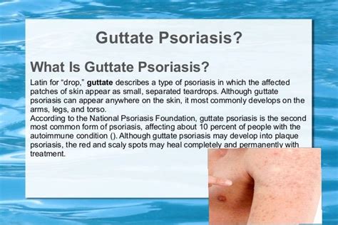 Guttate psoriasis