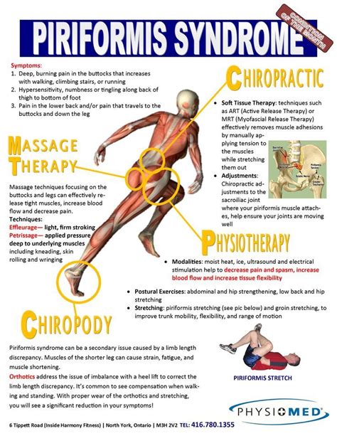 piriformis syndrome after hip replacement - mcdougal-mezquita