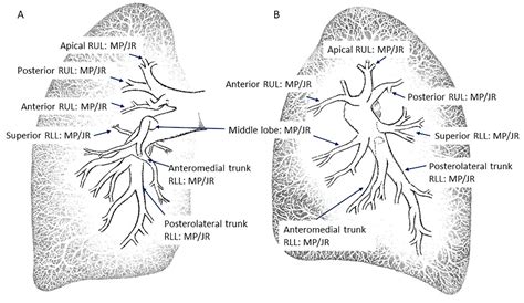 JCM | Free Full-Text | Selective Segmental Pulmonary Angiography ...