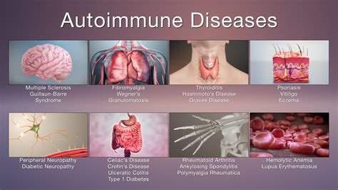 What are the 7 autoimmune diseases?