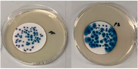 Microorganisms | Free Full-Text | Cefsulodin and Vancomycin: A ...