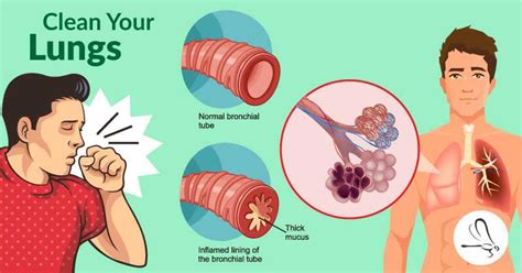 Remedies to Reduce Phlegm Right At Home - Healthy Holistic Living