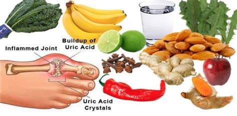 DIET CHART FOR ELEVATED URIC ACID LEVELS - Dr.Dugad