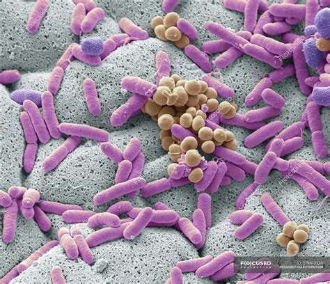 Scanning Electron Microscope Images Bacteria