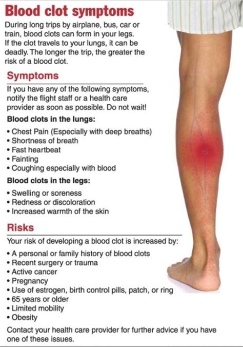 Do Blood Clots Cause Pain - Cares Healthy