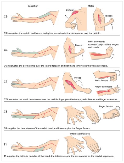 C5 C6 Cervical Radiculopathy (Pinched Nerve) Stretches & Exercises ...