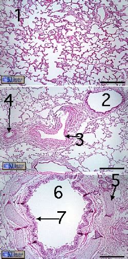 Pulmonary Artery Histology