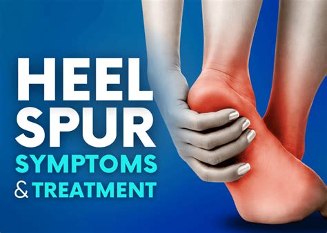 What is Heel Spur: Symptoms, Diagnosis and Treatment - Turan&Turan