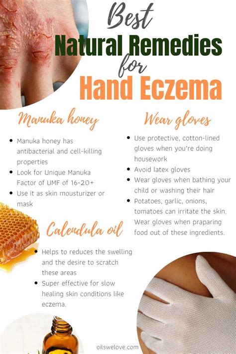 How to use manuka honey for eczema and cure it naturally – Artofit