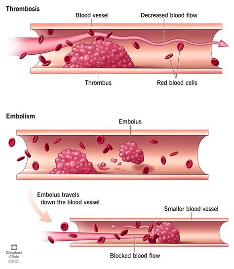 Blood Clots Form Using Which of the Following Components Answer