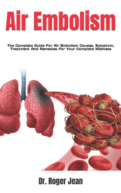 Air Embolism: The Complete Guide For Air Embolism Causes, Symptom ...