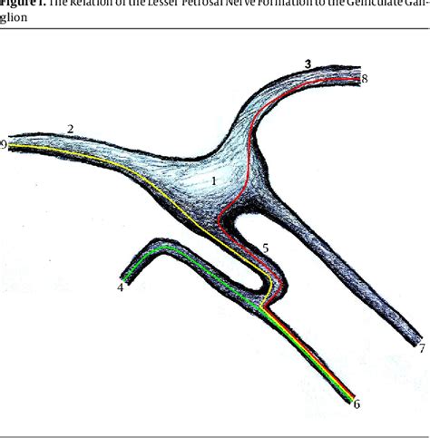 Figure 1 from Clinical Anatomy of the Lesser Petrosal Nerve | Semantic ...