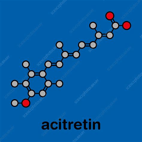 Acitretin psoriasis drug, molecular model - Stock Image - F025/1566 ...