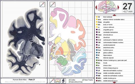 The Human Brain · Atlas of the Human Brain · Sections · Virtual Microscopy