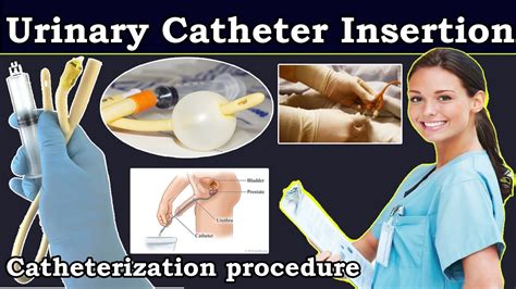 Urinary Catheter Insertion | Catheterization procedure nurses | How to ...