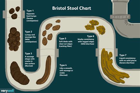 Eine Übersicht über das Bristol Stool Chart