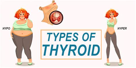 Thyroid Disease: Types, Symptoms, Causes, Preventions, Risk Factors ...