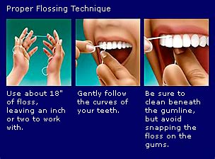 Basic Practices for Excellent Dental Health