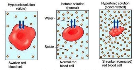 [Solved] A Doctor ordered to Administer a Hypotonic intravenous solut