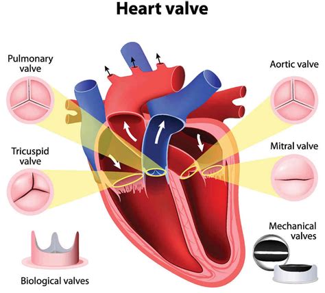 Mitral Valve And Aortic Valve