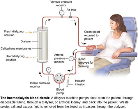 NHFKP | A new hope for kidney patients!