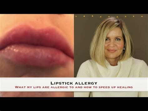 Why Are My Lips Allergic To Everything | Lipstutorial.org