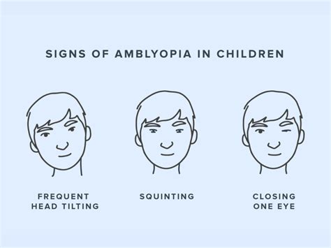 Amblyopia: What Is a Lazy Eye? | Warby Parker