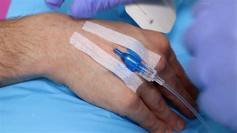 Intravenous cannulation (IV) - OSCE Guide | Geeky Medics