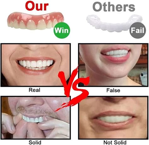 Women's Realistic Veneers Teeth - Upper and Lower Dentures for Missing ...