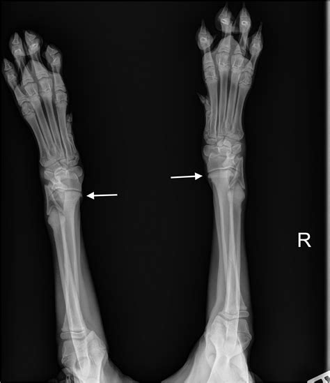 Hypertrophic osteodystrophy in dogs - Selman - 2022 - Journal of Small ...