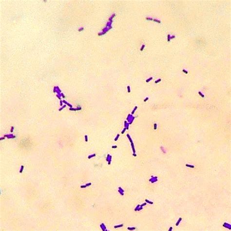 Lactobacillus Casei Gram Stain