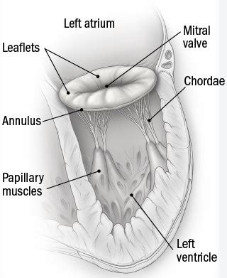 What causes a leaky mitral valve? - Harvard Health