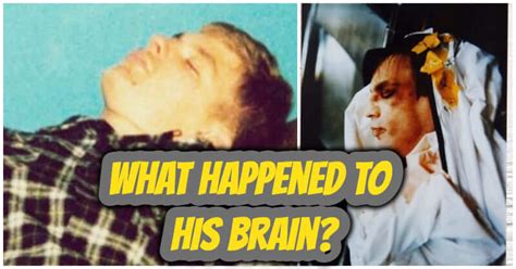 Jeffrey Dahmer Autopsy Prison: What Happened To His Brain?