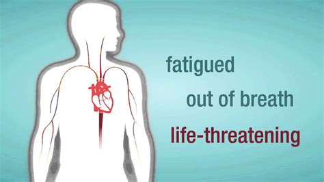 Problem: Mitral Valve Regurgitation | American Heart Association