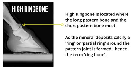 What Is Ring Bone In Horses? - Symptoms & Treatment