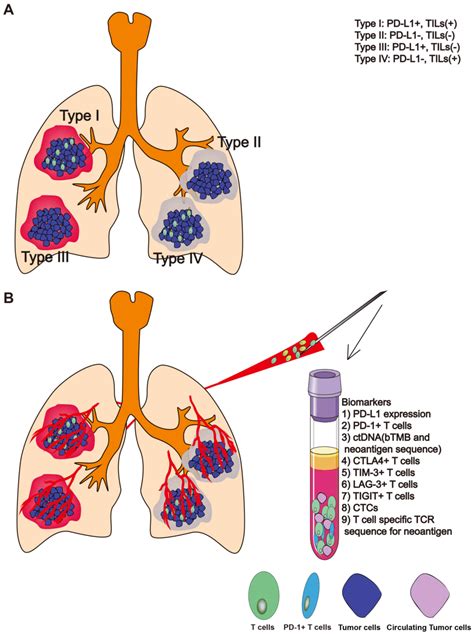 Different Types Lung Cancer