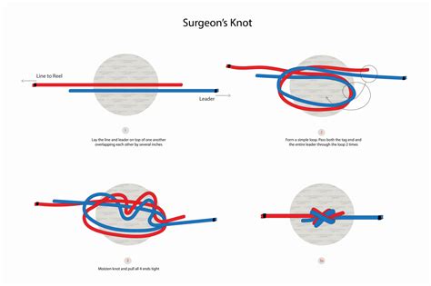 How to Tie a Surgeon's Knot: Quick Guide