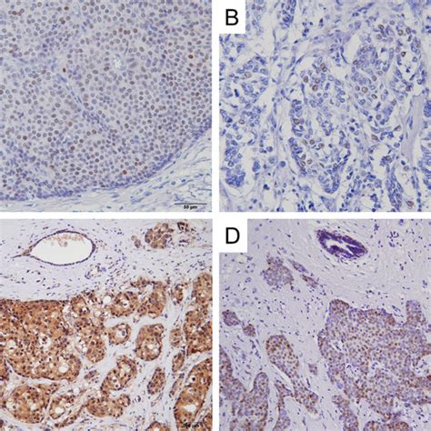 Correlation between PIK3CA mutation status and clinicopathological ...