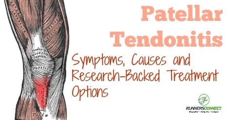 Patellar Tendonitis and Running: Symptoms, Causes and Research-Backed ...