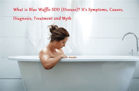 What is Blue Waffle SDD (Disease) It’s Symptoms, Causes, Diagnosis ...