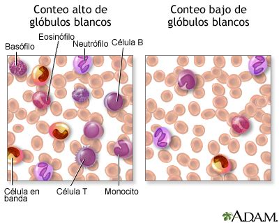 Conteo de glóbulos blancos - Serie—Resultados: MedlinePlus enciclopedia ...