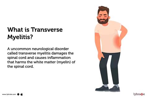 Transverse Myelitis: Treatment, Procedure, Cost, Recovery, Side Effects ...