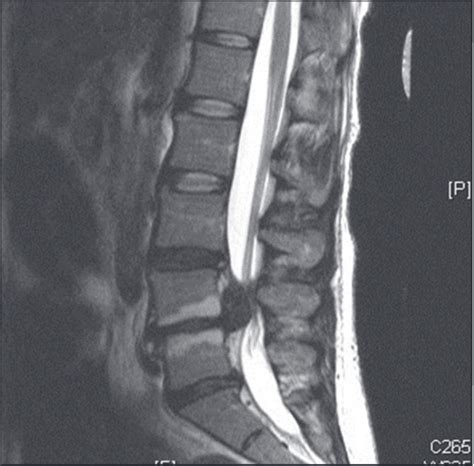 Pin on CMAJ clinical images